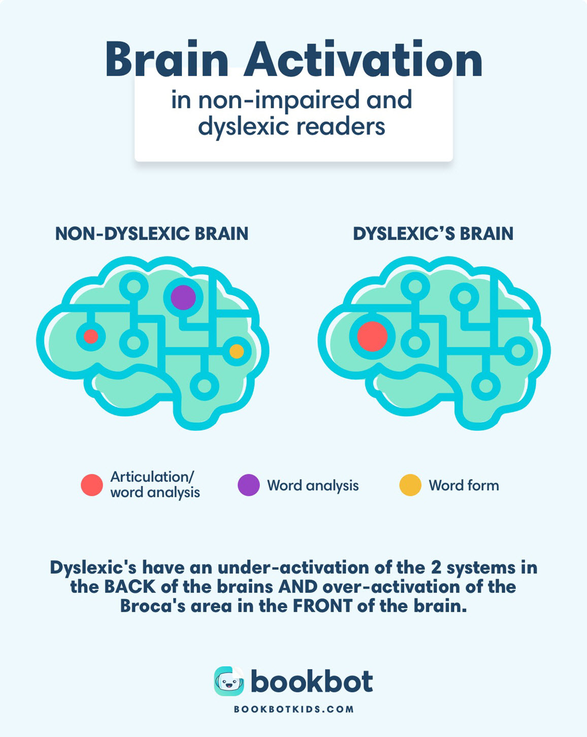 how a dyslexic brain works